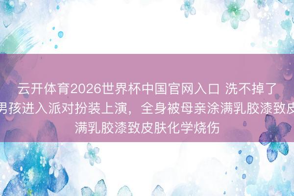 云开体育2026世界杯中国官网入口 洗不掉了！阿根廷一男孩进入派对扮装上演，全身被母亲涂满乳胶漆致皮肤化学烧伤