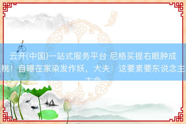 云开(中国)一站式服务平台 尼格买提右眼肿成核桃！自曝在家染发作妖，大夫：这要素要东说念主命